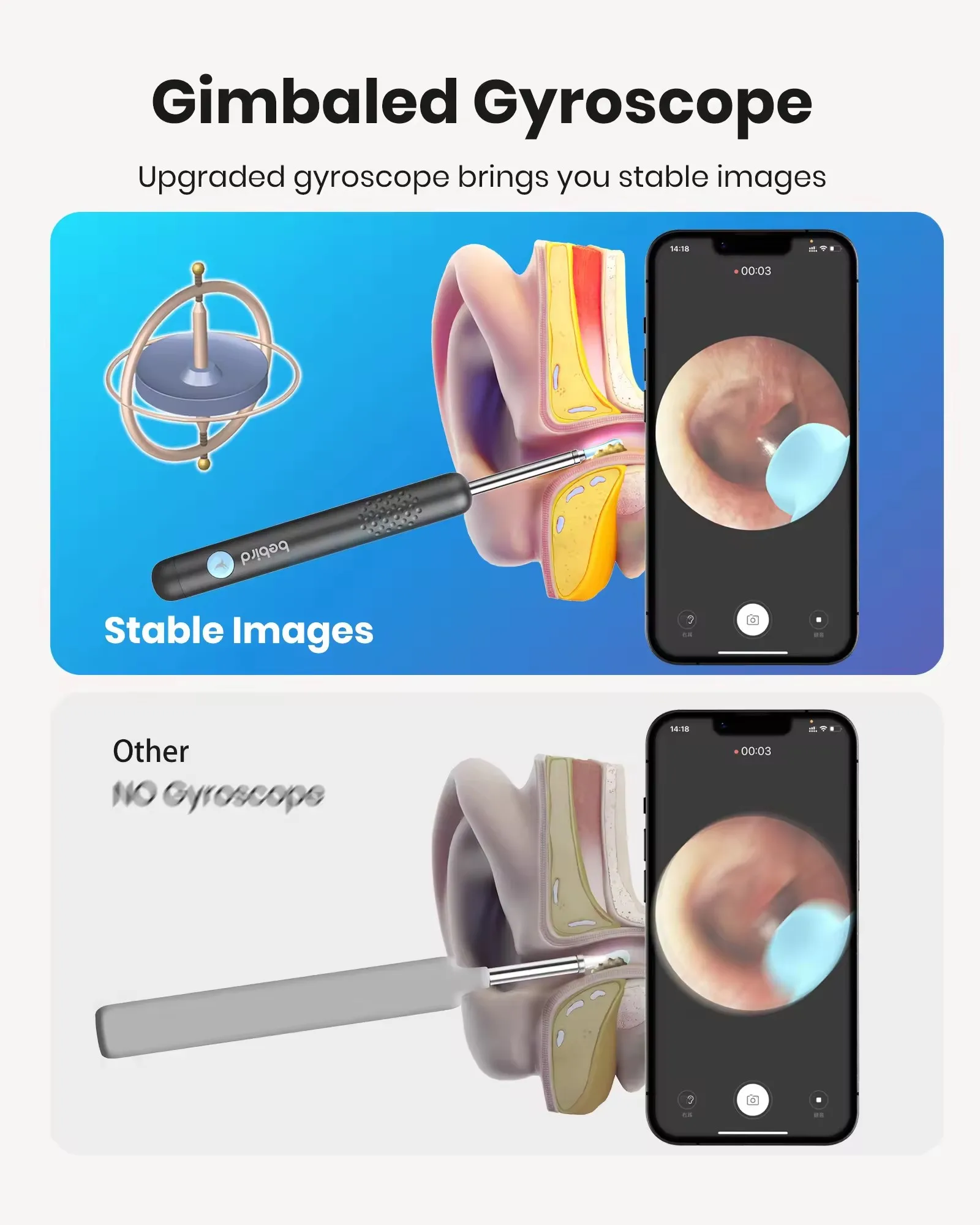 Bebird Smart Visual Ear Sticke - Iris Photography Led Lighting Pack ulasan dan harga